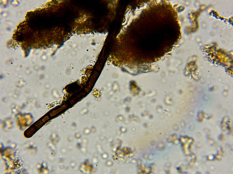 Fungal hypha, microscope, regenerative hemp farming