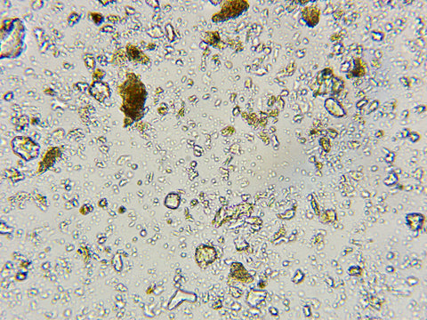 Microscope image of dirt, regenerative hemp farming