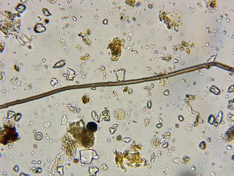 Fungal hypha, carbon sequestration, microscope, regenerative hemp farming