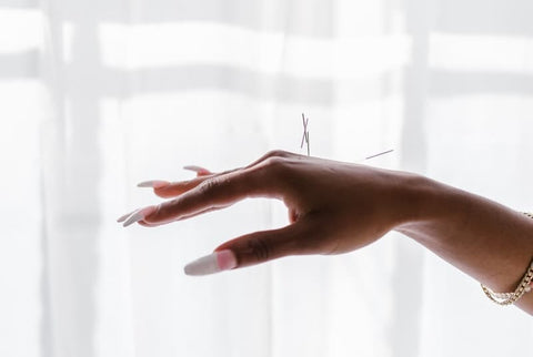 Acupuncture as a possible alternative to vaginal numbing creram