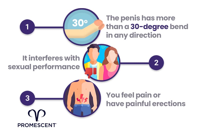 How much curve is too much curve for your penis?