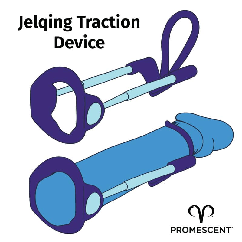 Illustration showing jelqing traction device, both with and without penis inserted into device