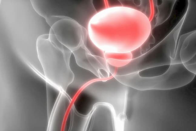 intercourse and ejaculation can reduce the chances of prostate cancer