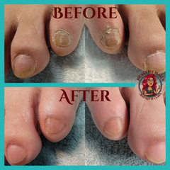 Advanced Pedicure Before and After