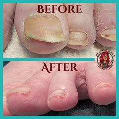 advanced pedicure before and after image