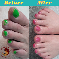 Advanced Pedicure Results