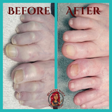 advanced pedicure before and after