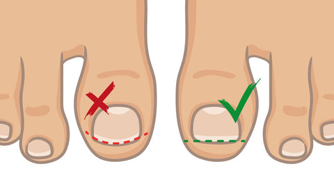 proper cutting of toenails diagram