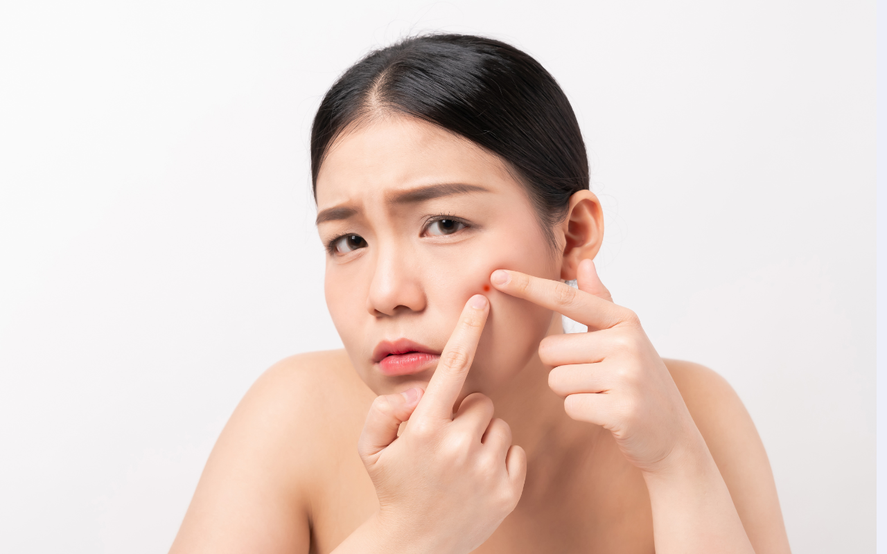 pimple