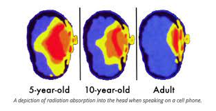 children skull brain damage emf cancer radiation 5g