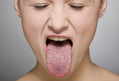 4 Possible Causes And Fixes For Vaper's Tongue That By Scie