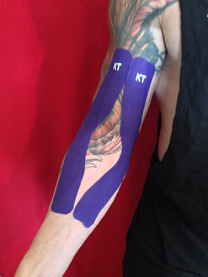 KT Tape for bicep and forearm tendinitis