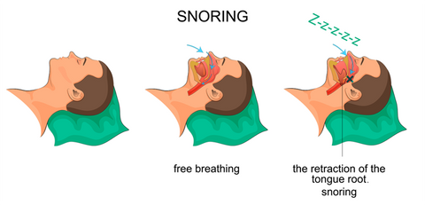 Why People Snore Uniquesimple.com