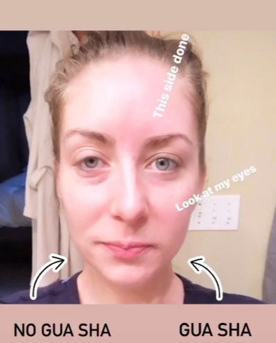 Wildling Gua Sha Before & After | Your Toxic Free Momma