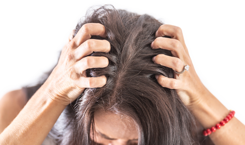 itchy scalp.png__PID:44797ac5-52e7-4d0c-8872-354dbee2543f