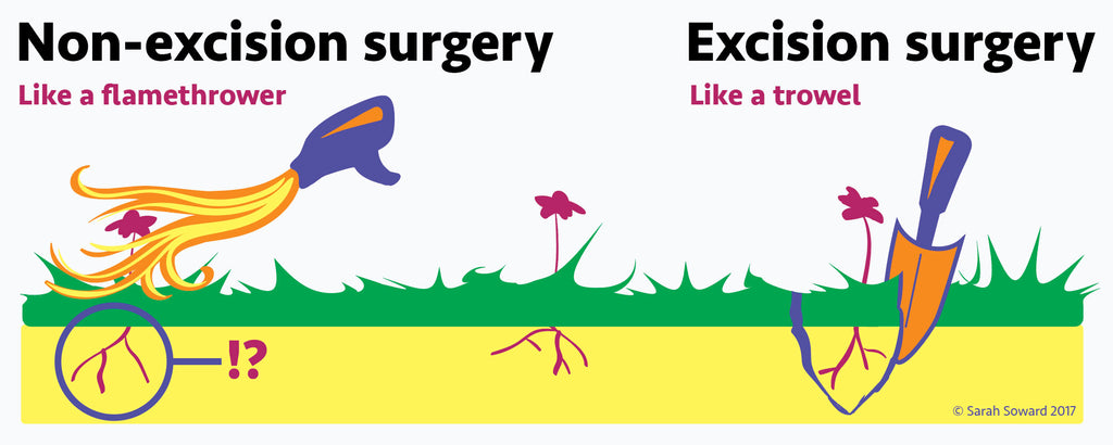 Non-excision surgery (like a flamethrower) vs excision surgery (like a trowel). Copyright Sarah Soward 2017. Digital cartoon drawing of a flamethrower removing the top of a flower but leaving the roots below followed by a flower with the roots showing below the ground followed by a trowel carefully removing the flower's roots to remove the flower completely and forever.