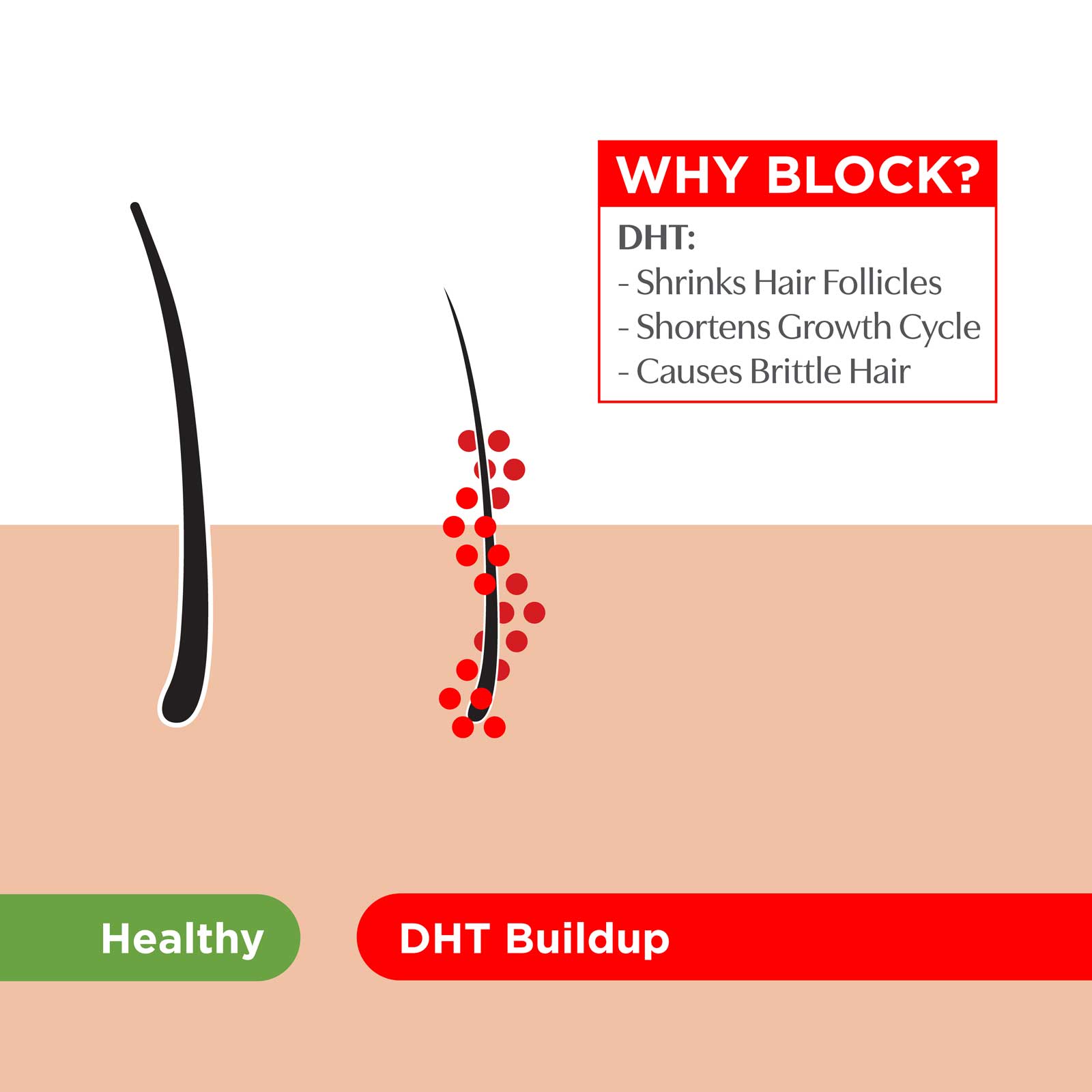 Trichos  DHT Hormone  Hairloss Causes