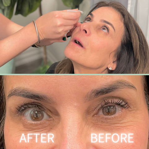 two part graphic: image 1 is a medical professional putting eye drops in a woman's right eye. image 2 is a before an after, showing that the woman's right eye is more open after the drops.