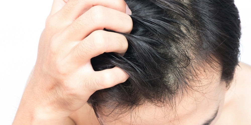 How To Treat Your Itchy Scalp FAST  VITAMAN  VITAMAN USA