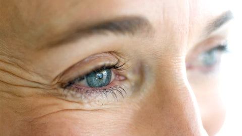Eye Wrinkles: Causes, Prevention & Treatment