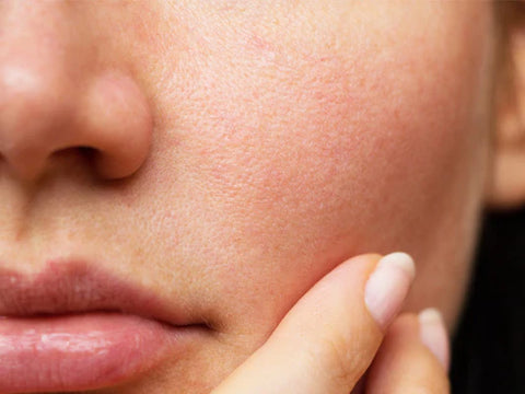 Pores