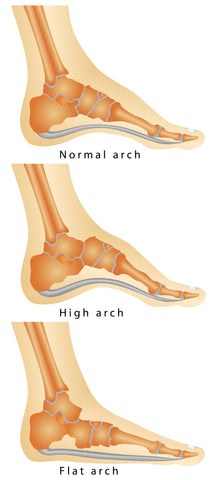 foot arch stretches