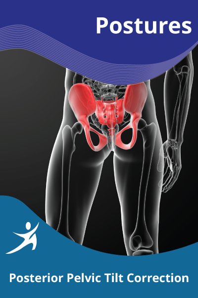 Posterior Pelvic Tilt Correction Easyflexibility