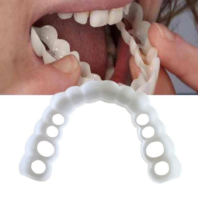 magic teeth brace