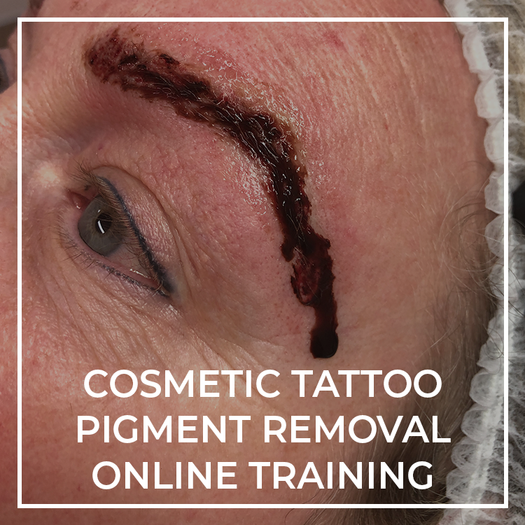 Laser Tattoo Removal Course  Sydney College of Hair  Beauty