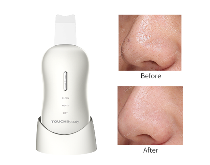 Remove blackheads, cleanse and lift with Agaro Ultrasonic Facial Skin  Scrubber 