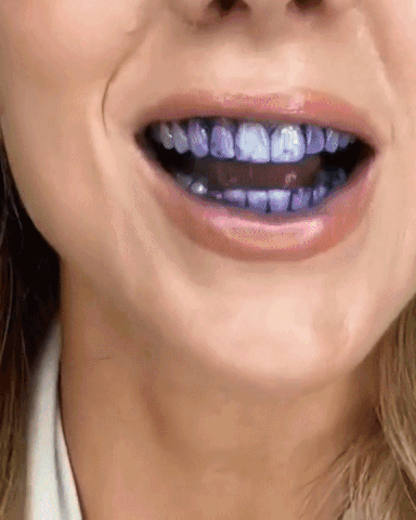 v34™ Dental Color Corrector — Loorens