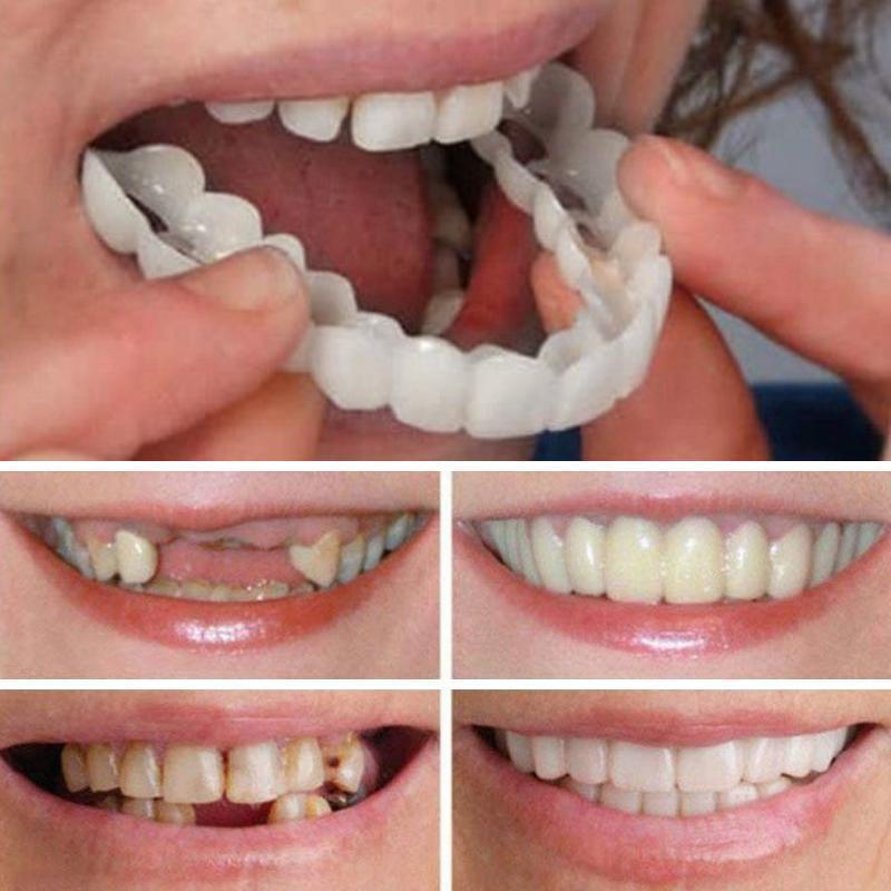 cost of snap in dentures