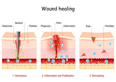 Tissue healing