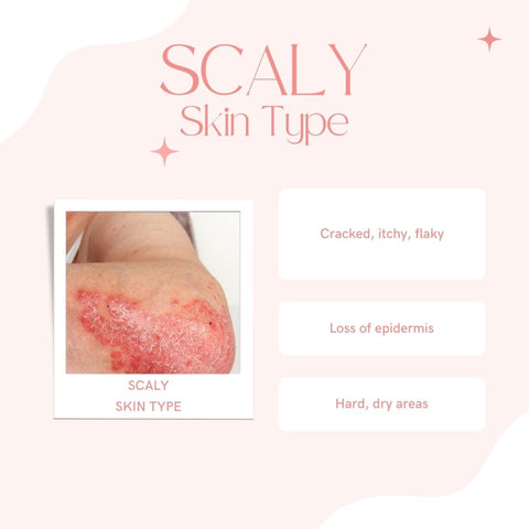 scaly skin type