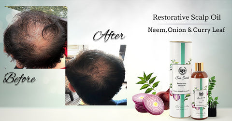 Seer Secrets Onion Hair Oil 200ml- For Hairfall Control |  https://www.seersecrets.com/