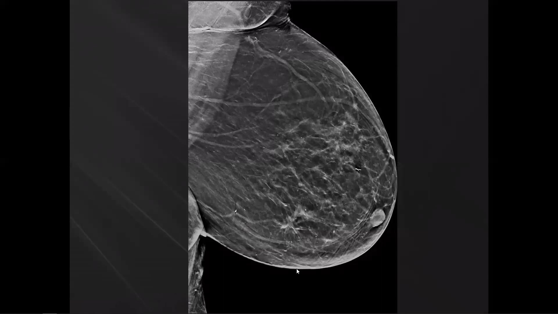 Picture of Individual Lectures in Breast Tomosynthesis