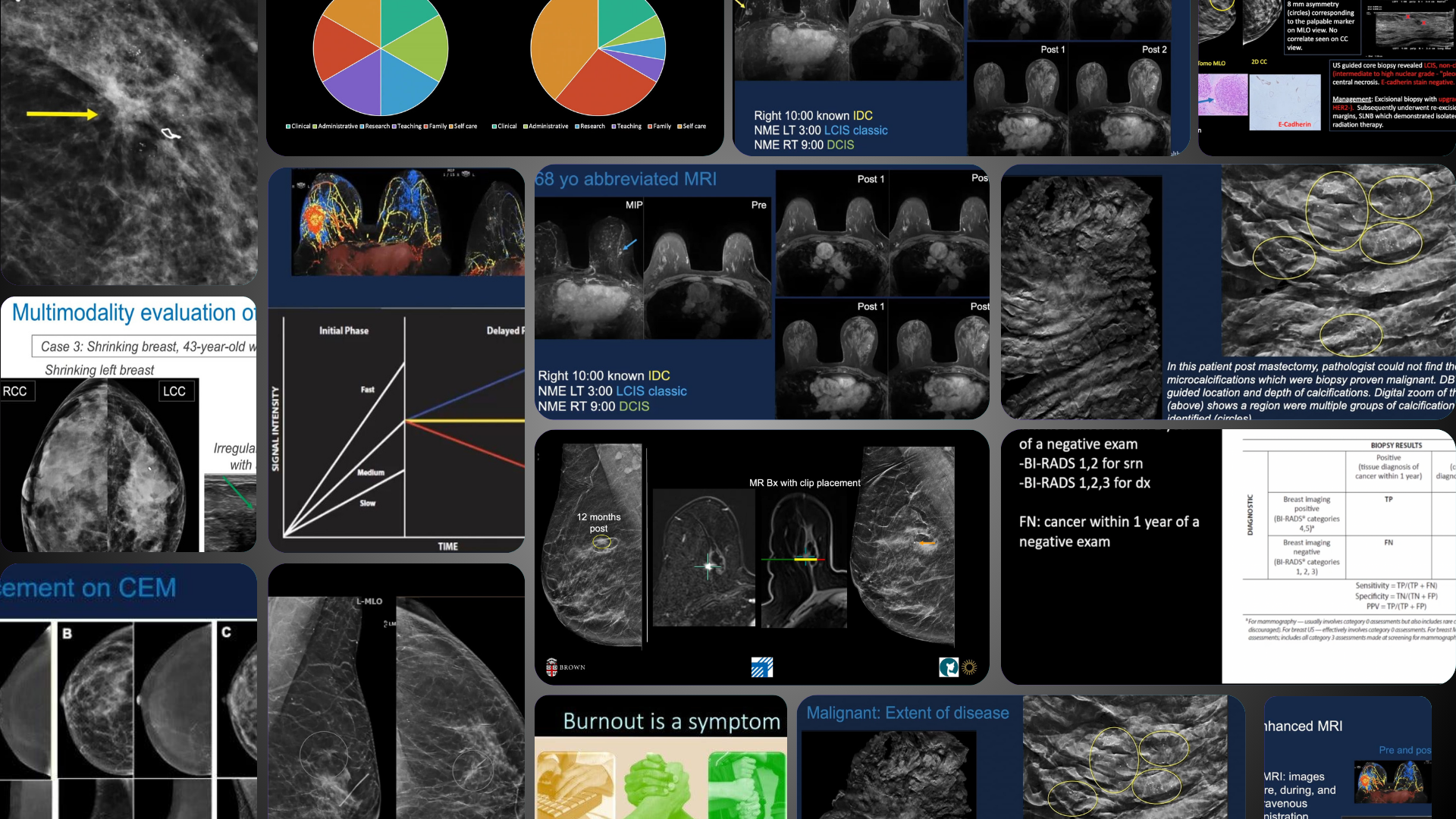 Picture of Breast Imaging CME: Hot Topics Part III