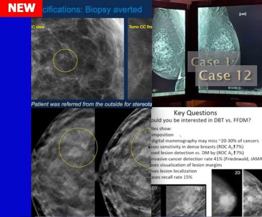 Breast Tomosynthesis with Modality Training for MQSA - Efficiency Learning Systems