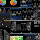 Picture of Breast Imaging CME: Hot Topics III