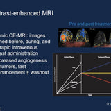 Picture of Breast Diffusion Weighted Imaging
