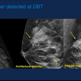 Picture of Diagnostic Breast Imaging and Interventions in the age of Digital Breast Tomosynthesis