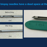 Picture of Stereotactic Biopsy Using Digital Breast Tomosynthesis