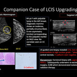Picture of Crack the Case: Challenging Biopsy and Concordance Scenarios