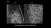 Picture of Cracking the Case: Challenging Calcifications