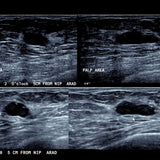 Picture of Breast Ultrasound with Dr. Gundry