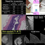 Picture of Breast Imaging CME: Hot Topics II