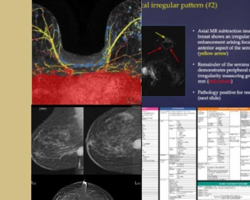 Vocabulary for Contrast Medium in Medical Imaging - Video & Lesson