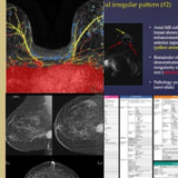 Picture of Breast Imaging CME: Hot Topics I