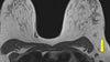 Breast MRI Bootcamp - Efficiency Learning Systems