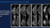 Contrast Enhanced Mammography: Techniques and Indication - Efficiency Learning Systems